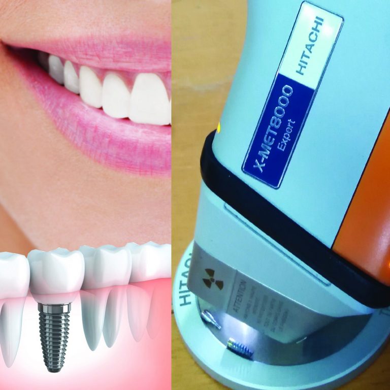 baner sprawdzanie inplantów