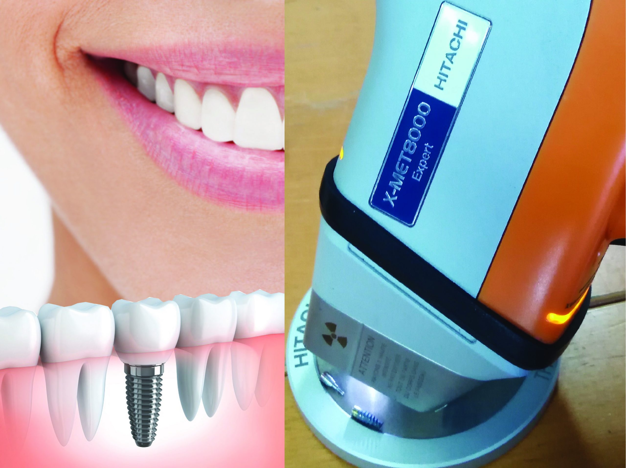 baner sprawdzanie inplantów